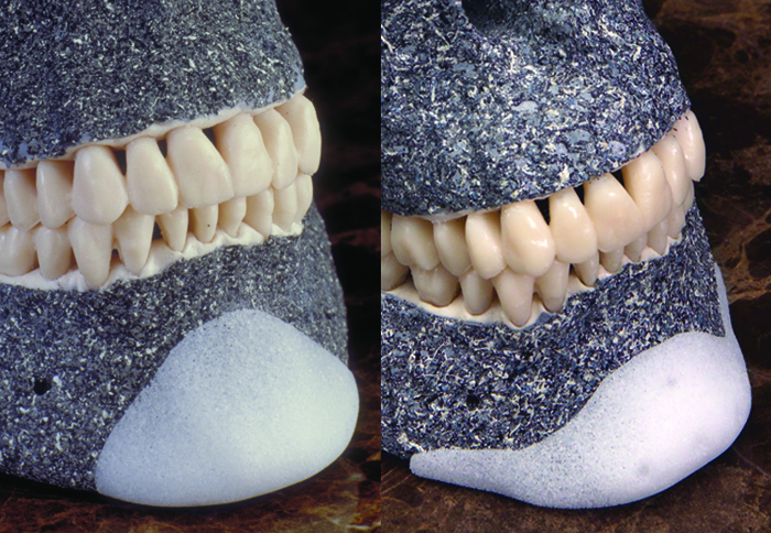 人工骨墊下巴模型