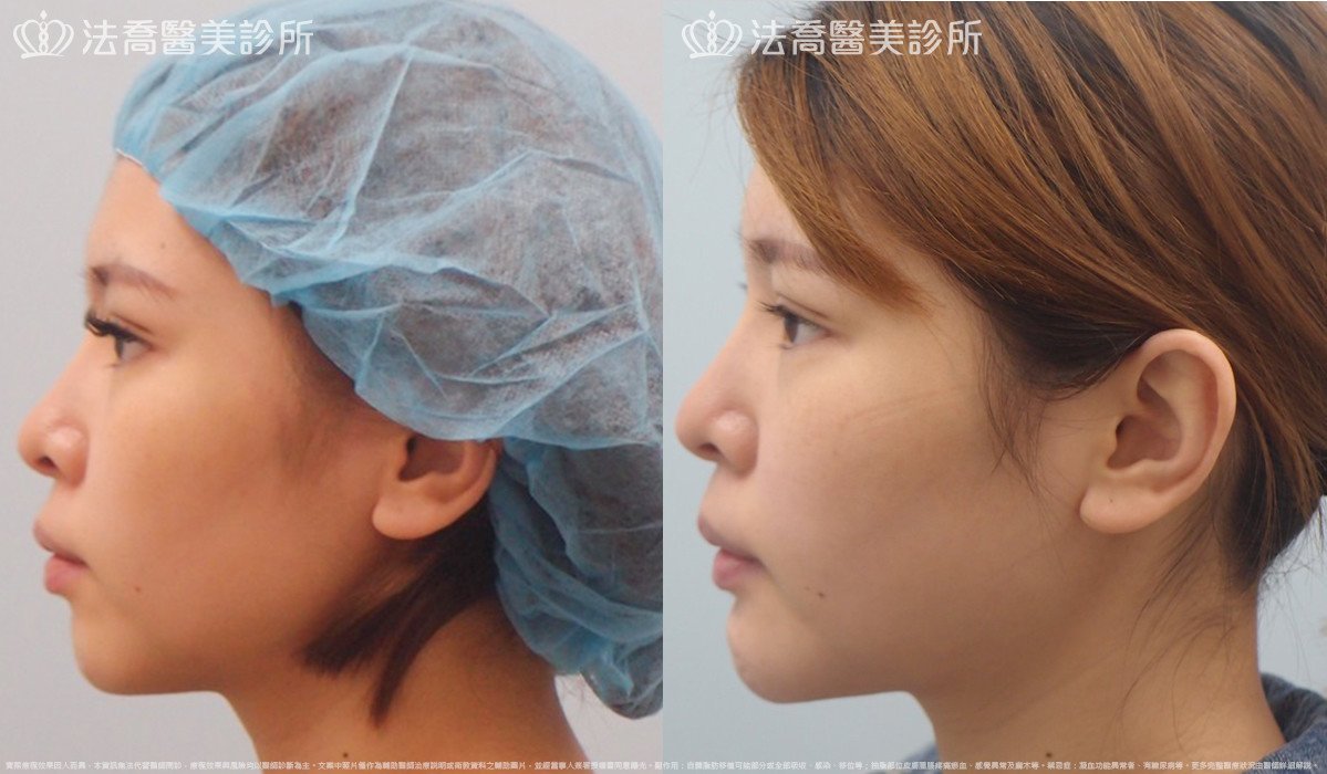 法喬醫美診所 邱浚彥醫師