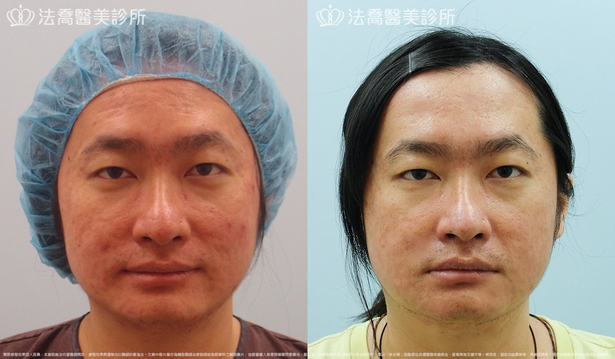 法喬醫美診所 邱浚彥醫師