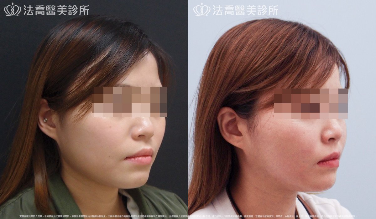 法喬醫美診所 邱浚彥醫師