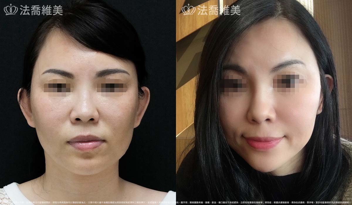 法喬維美,法喬醫美診所,邱浚彥