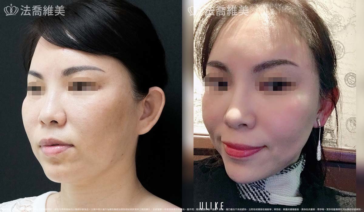 法喬維美,法喬醫美診所,邱浚彥