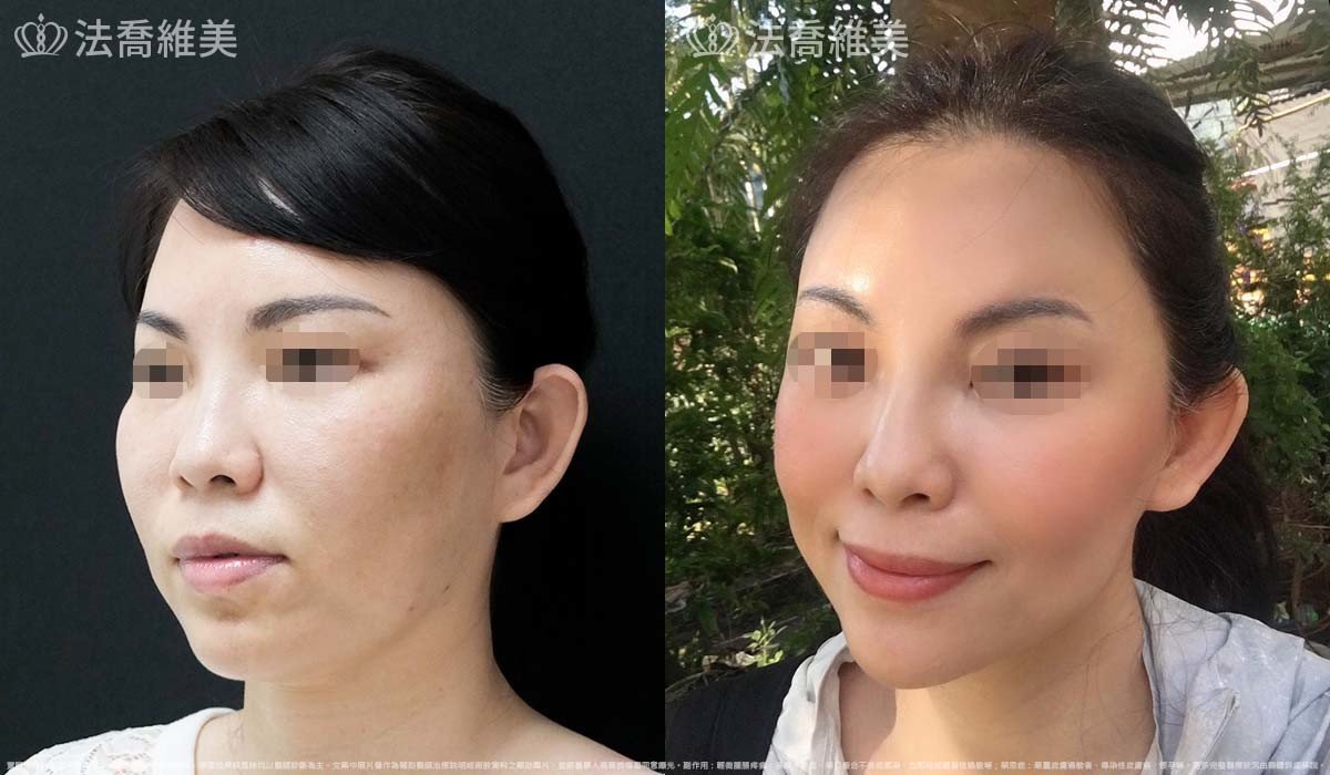 法喬維美,法喬醫美診所,邱浚彥