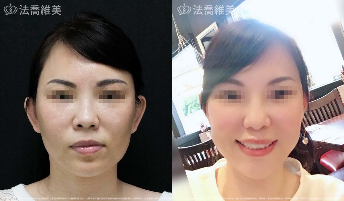 法喬維美,法喬醫美診所,邱浚彥