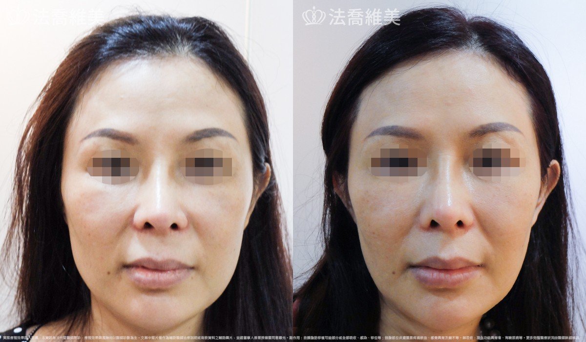 法喬維美醫美診所