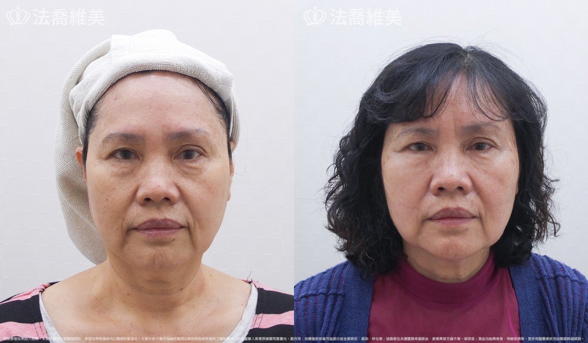 法喬維美醫美診所