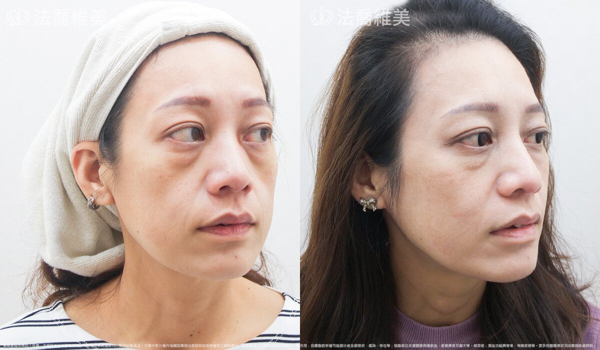 法喬醫美診所,邱浚彥,張慈恩