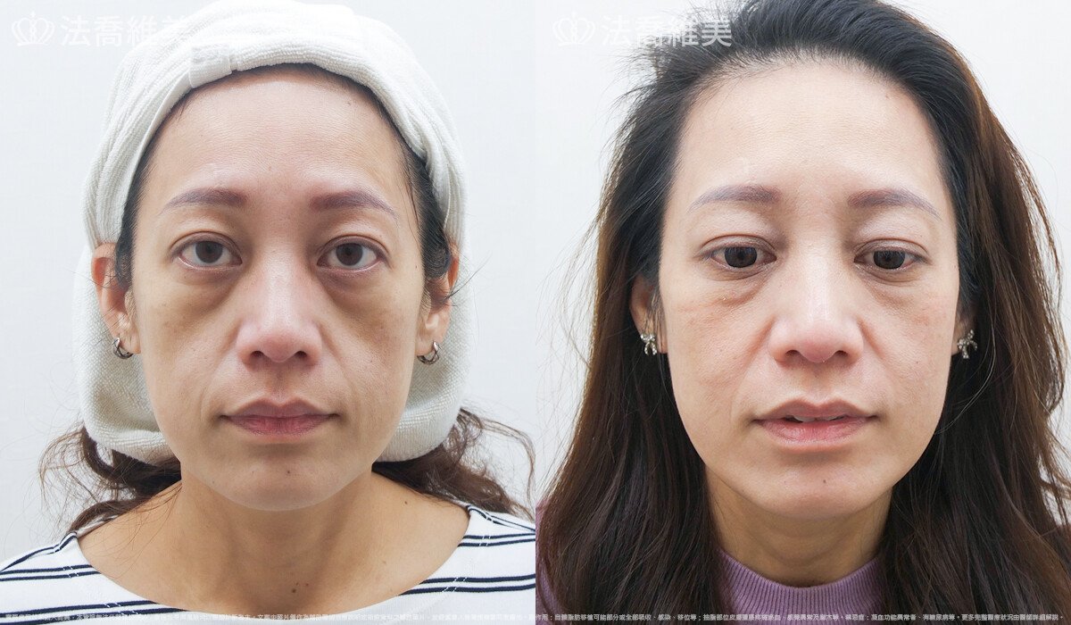 法喬醫美診所,邱浚彥,張慈恩