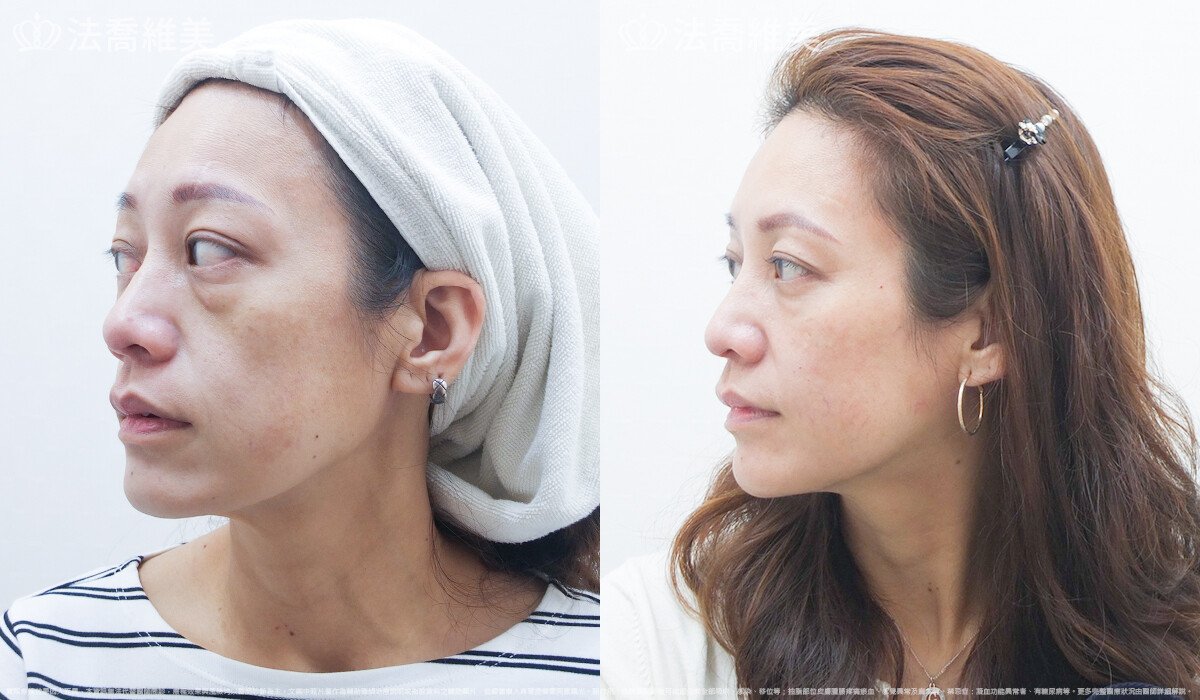 法喬醫美診所,邱浚彥,張慈恩