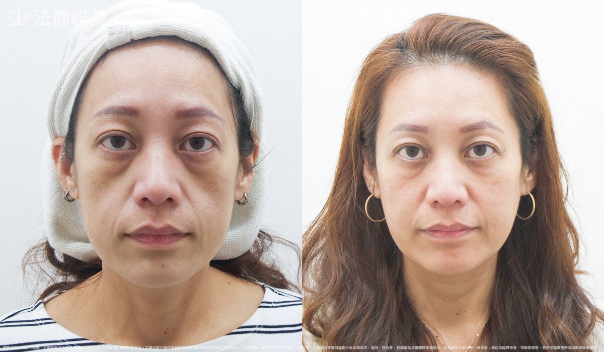 法喬醫美診所,邱浚彥,張慈恩