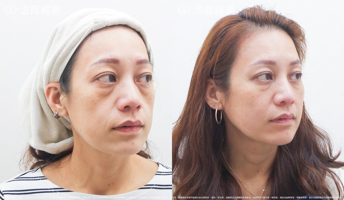 法喬醫美診所,邱浚彥,張慈恩
