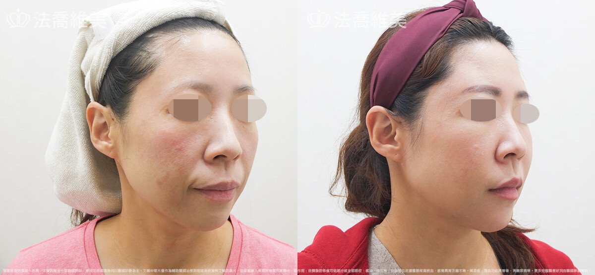 法喬醫美診所,邱浚彥,張慈恩