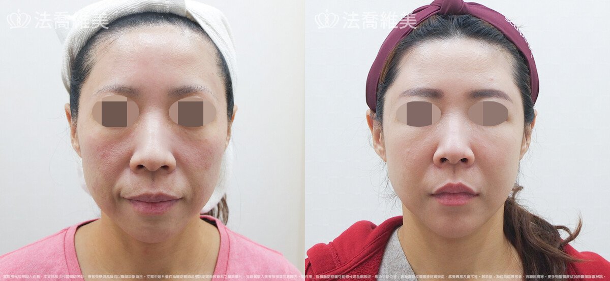 法喬醫美診所,邱浚彥,張慈恩