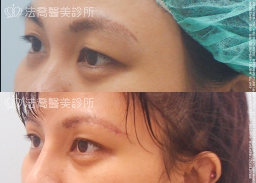 法喬醫美診所 邱浚彥醫師