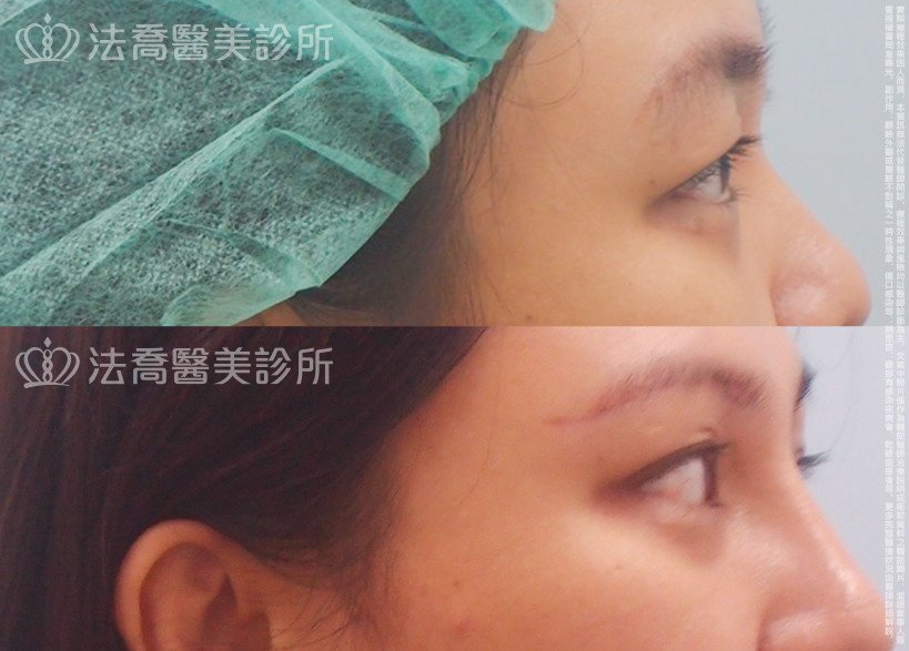 法喬醫美診所 邱浚彥醫師