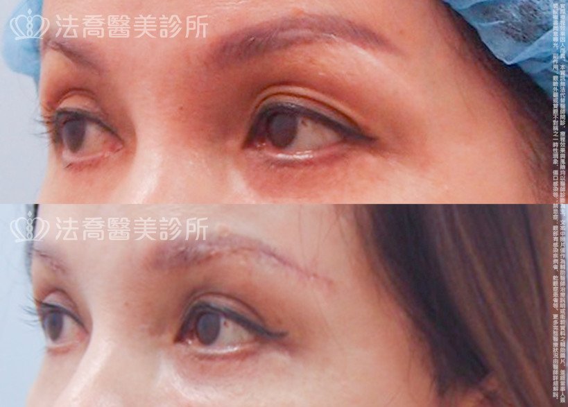 法喬醫美診所 邱浚彥醫師