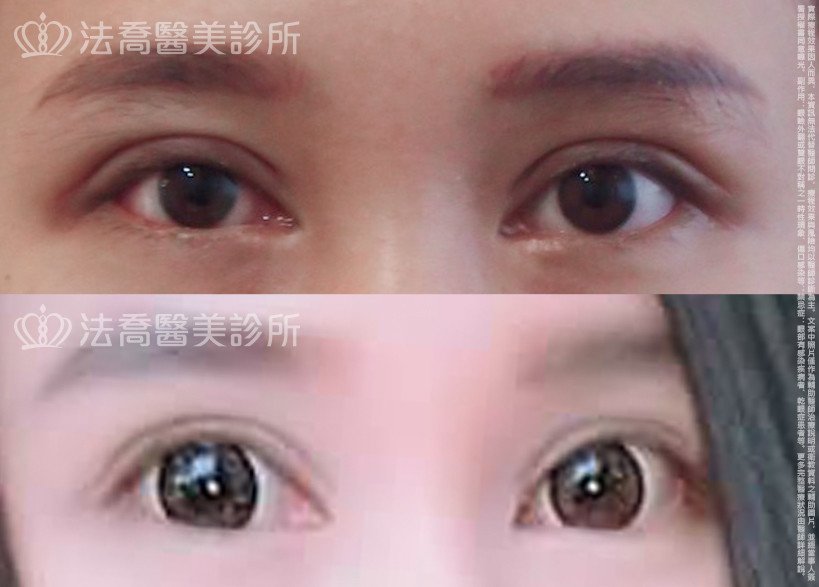 法喬醫美診所 邱浚彥醫師