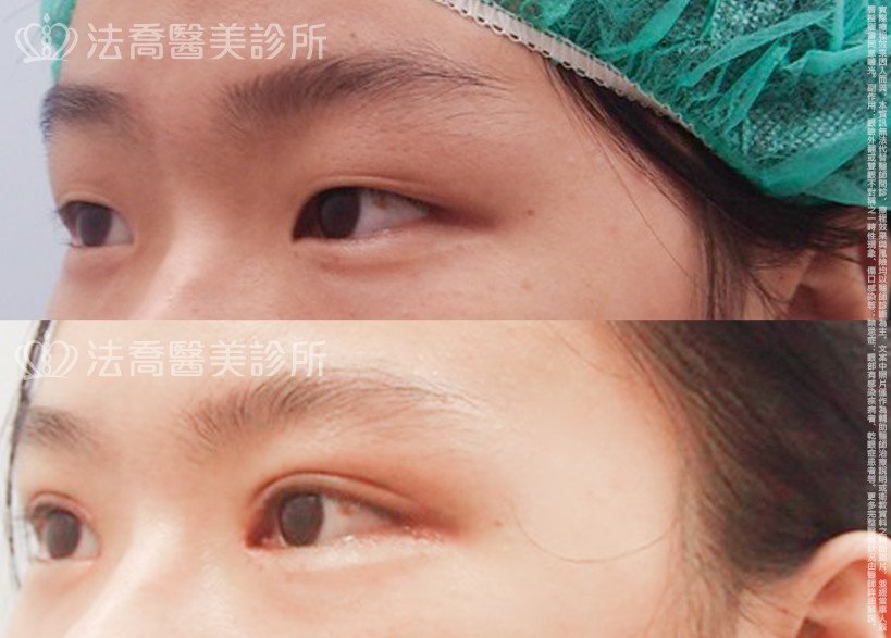 法喬醫美診所 邱浚彥醫師