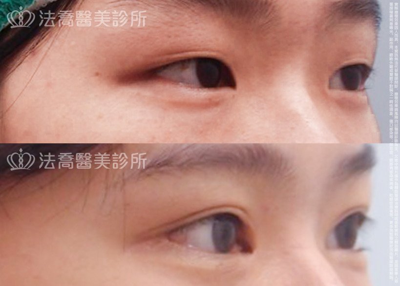 法喬醫美診所 邱浚彥醫師