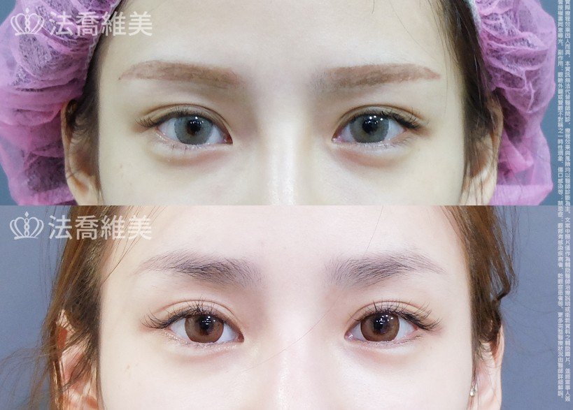 法喬維美醫美診所