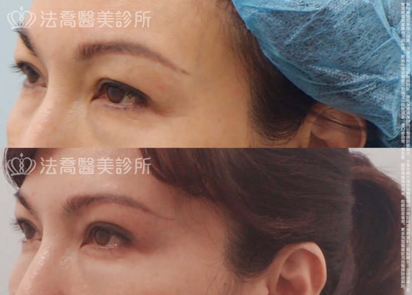 法喬醫美診所 邱浚彥醫師