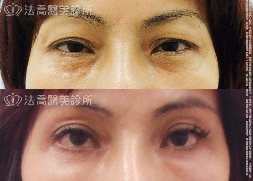 法喬醫美診所 邱浚彥醫師