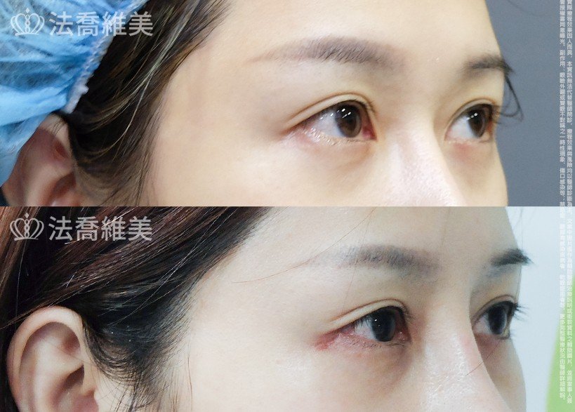 開眼尾