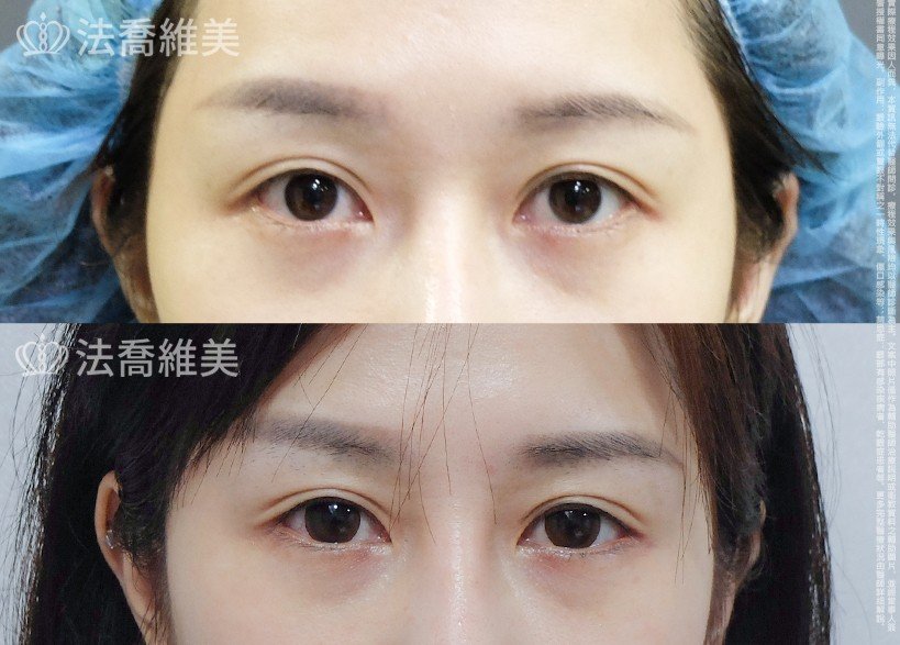開眼尾