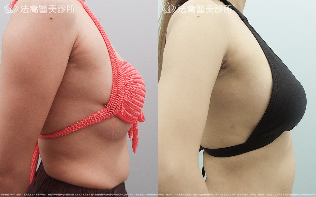 法喬醫美診所 邱浚彥醫師