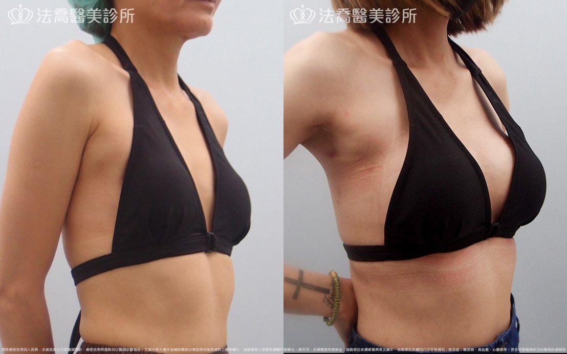 法喬醫美診所 邱浚彥醫師