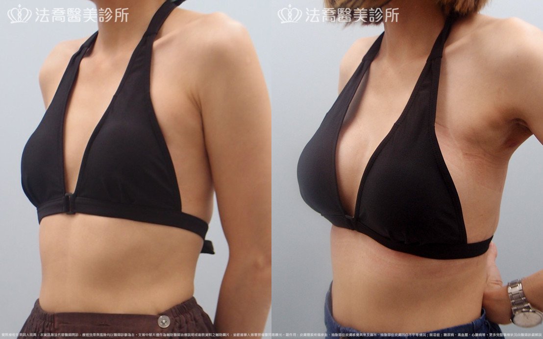 法喬醫美診所 邱浚彥醫師