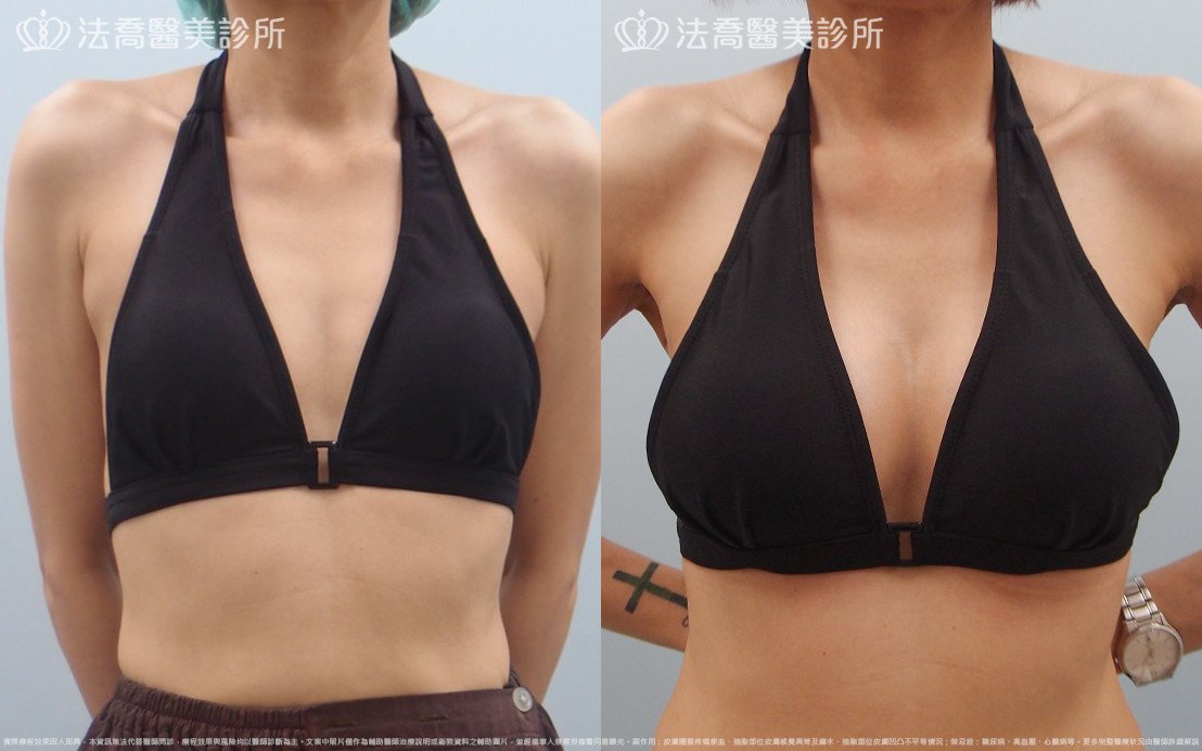 法喬醫美診所 邱浚彥醫師