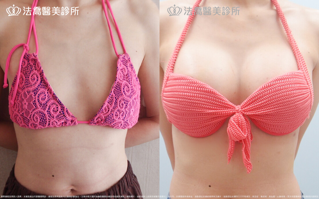 法喬醫美診所 邱浚彥醫師