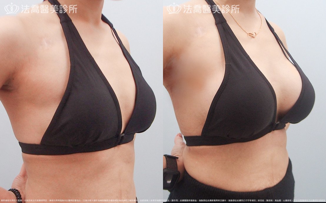 法喬醫美診所 邱浚彥醫師