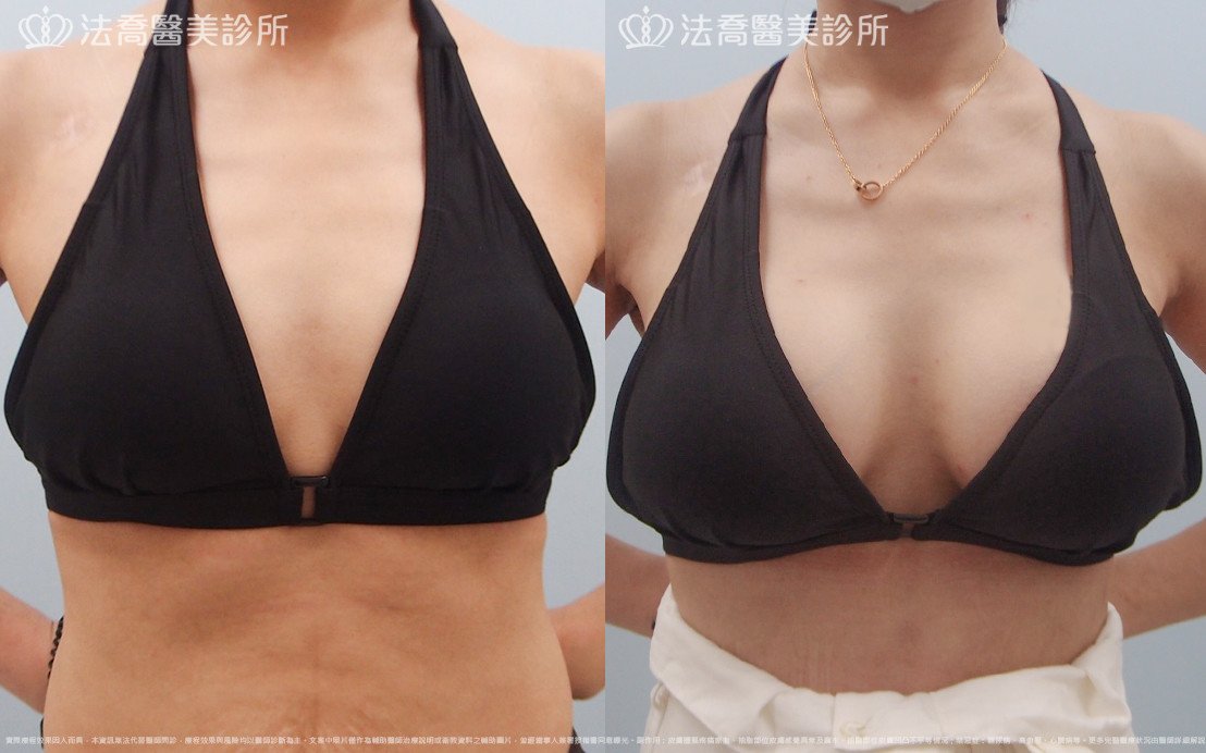 法喬醫美診所 邱浚彥醫師