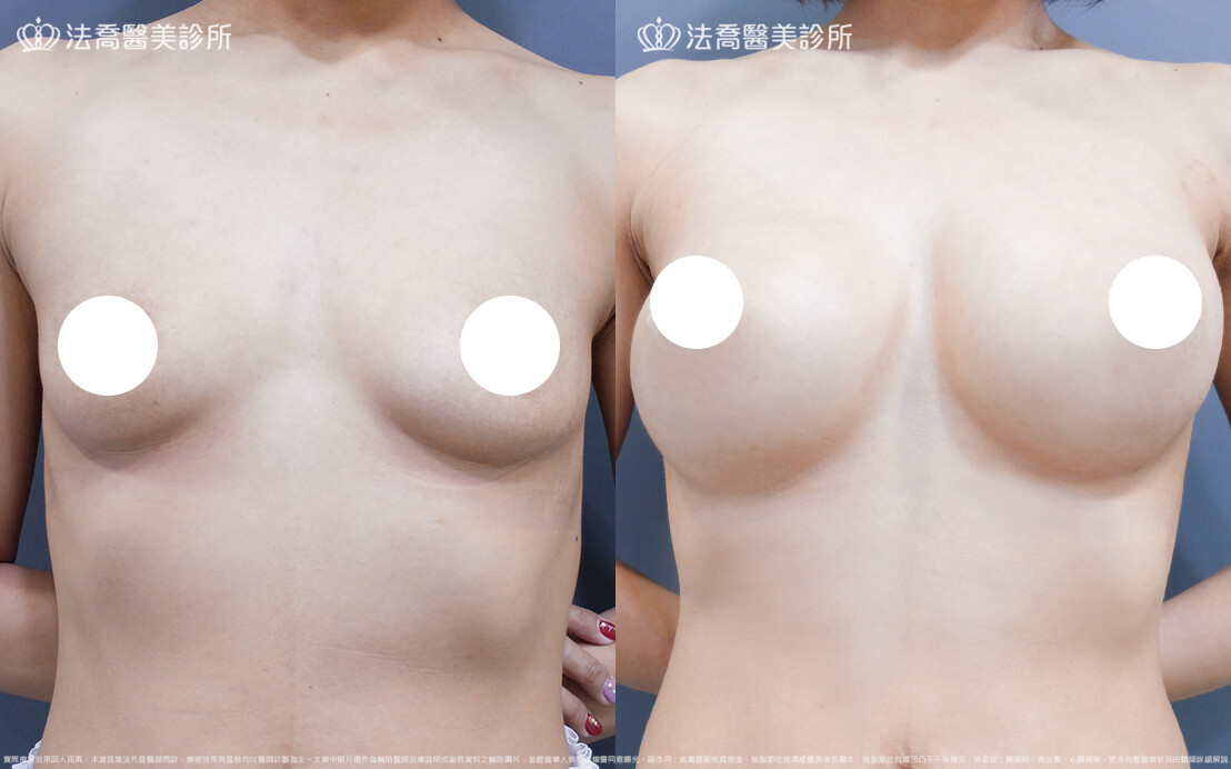 法喬維美醫美診所