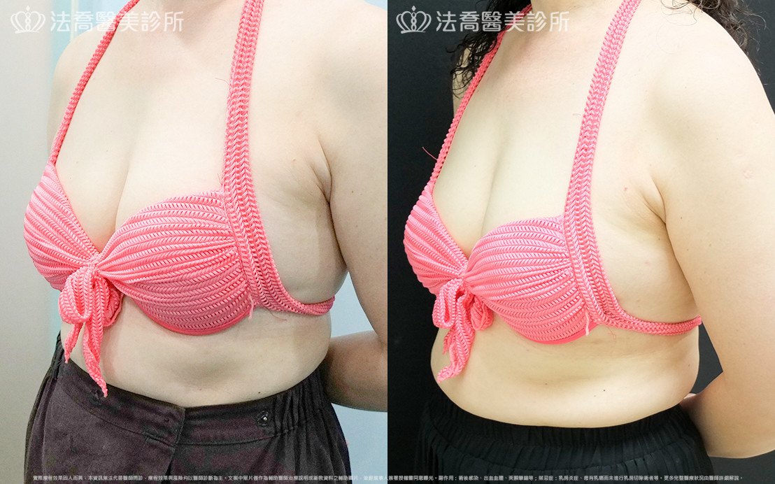 法喬醫美診所 邱浚彥醫師