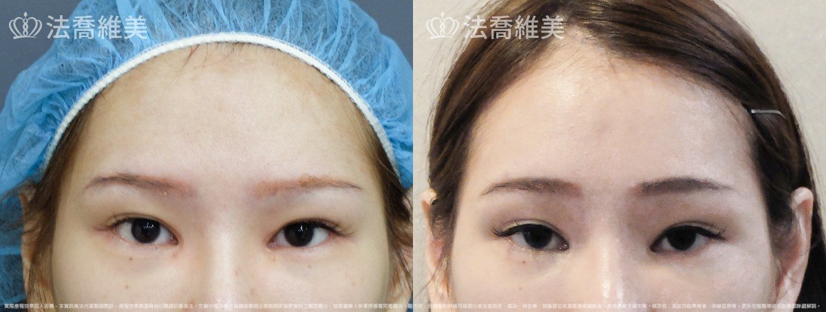 法喬維美醫美診所
