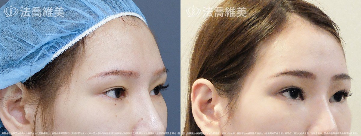 沈筠惇