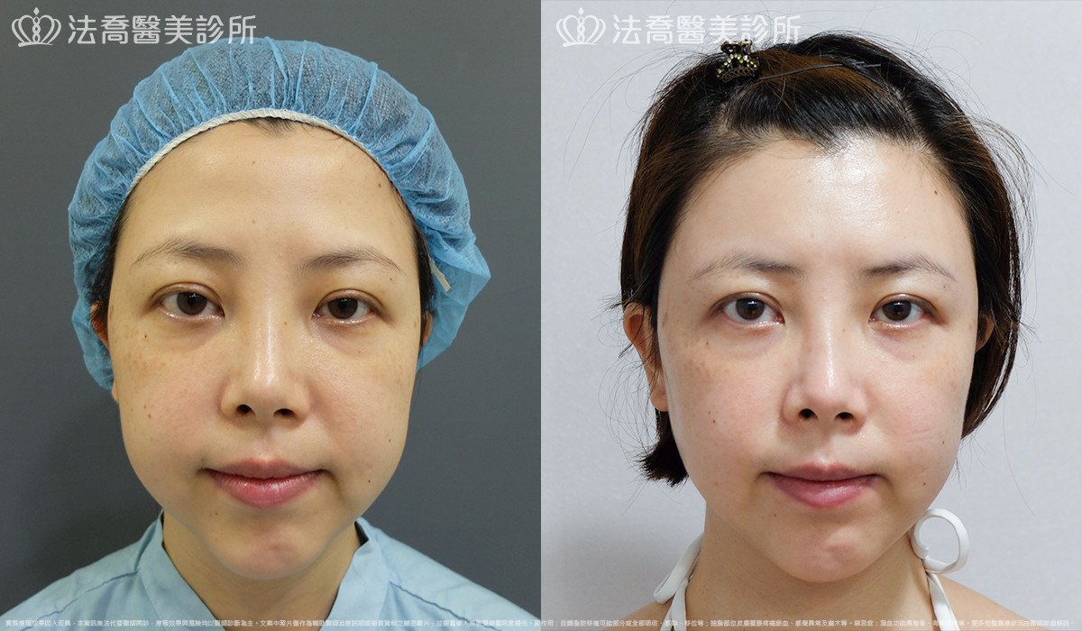 法喬醫美診所 邱浚彥醫師