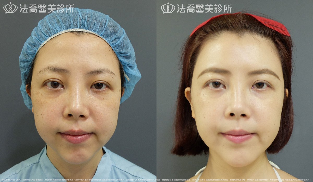 法喬醫美診所 邱浚彥醫師