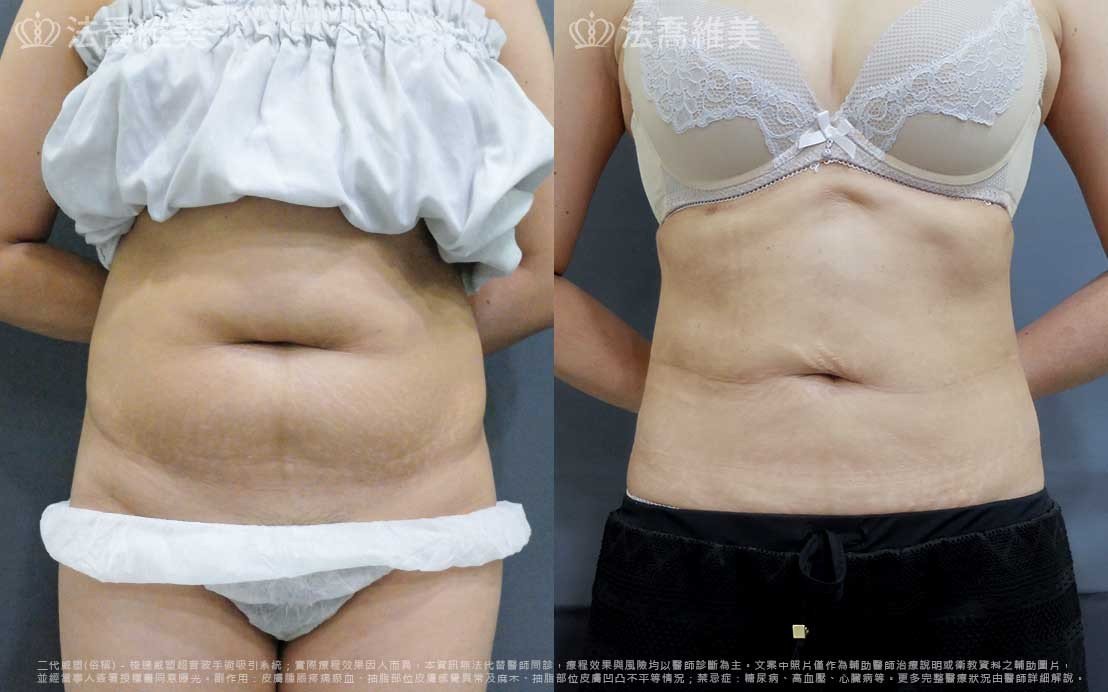法喬醫美
