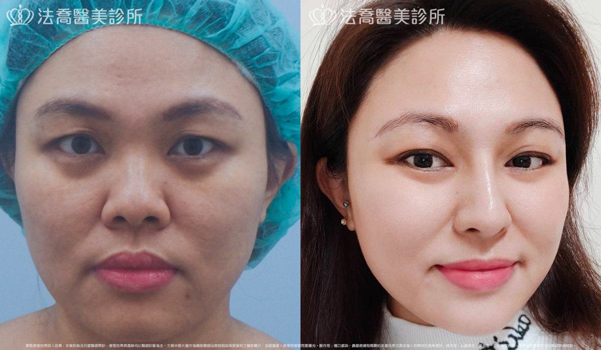 法喬醫美診所 邱浚彥醫師