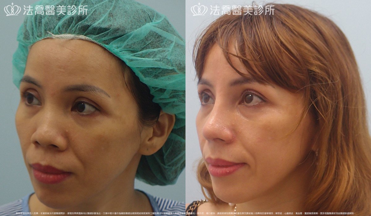 法喬醫美診所 邱浚彥醫師