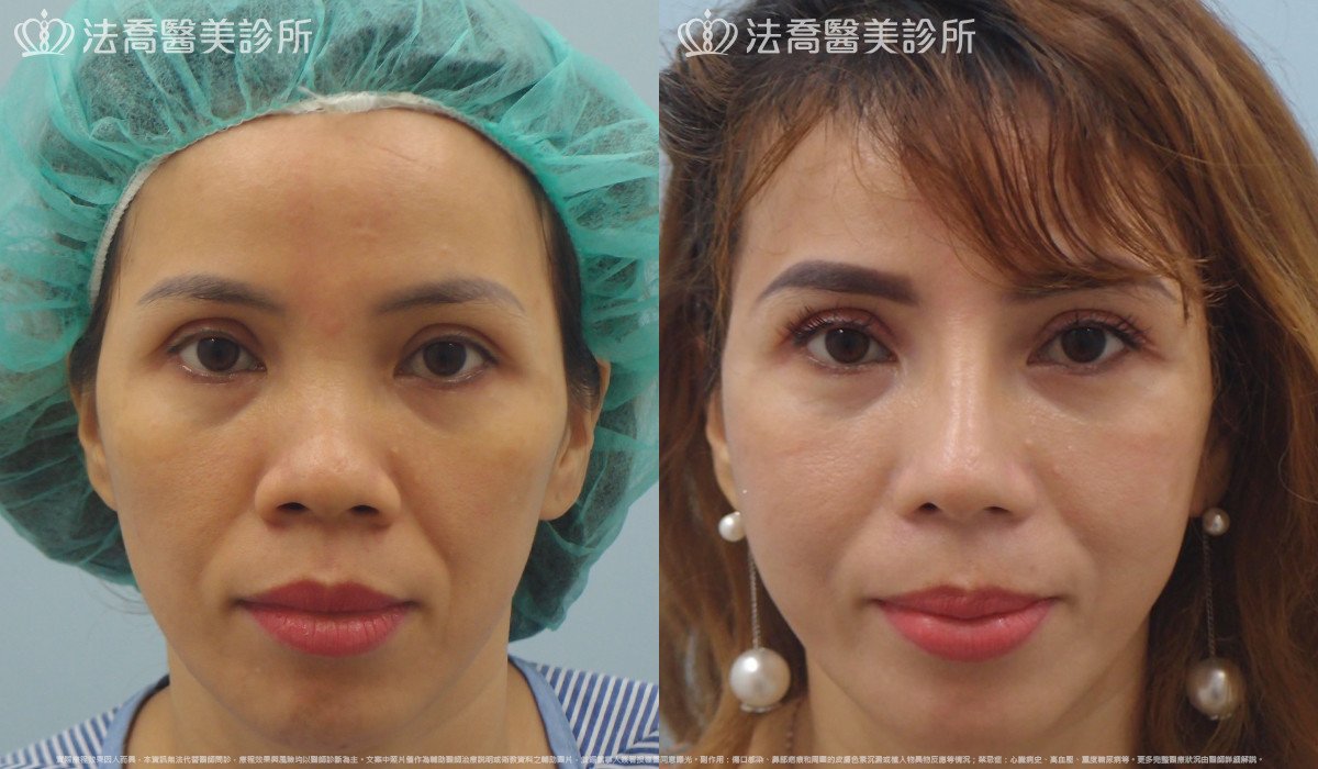 法喬醫美診所 邱浚彥醫師