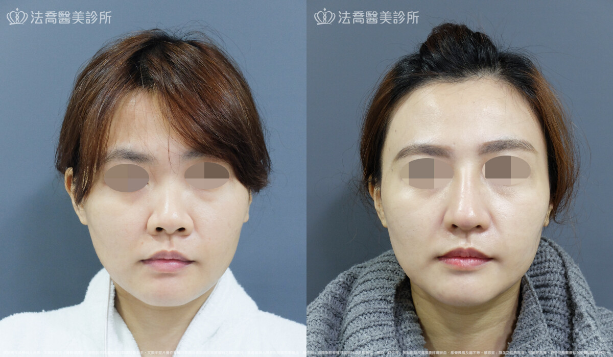 法喬維美醫美診所