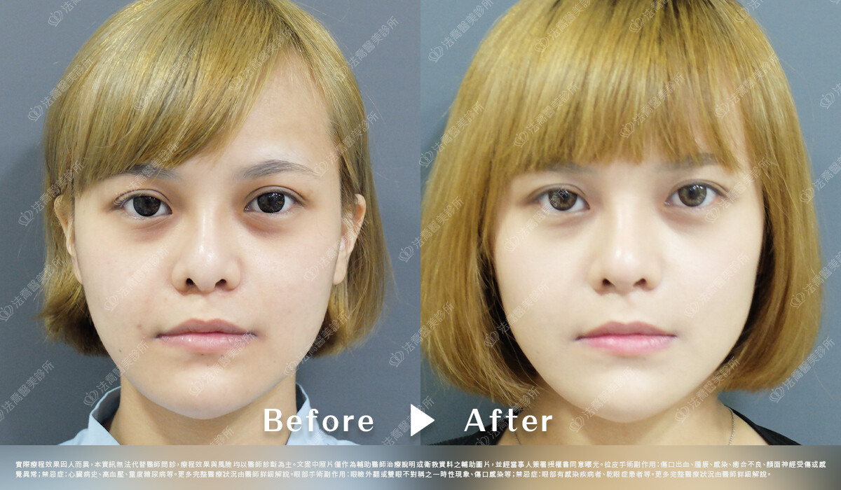 法喬維美醫美診所