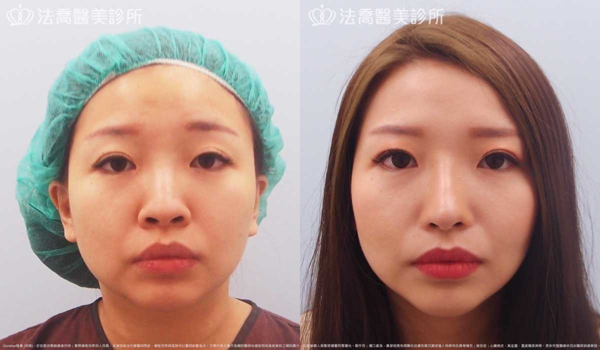 法喬醫美診所,邱浚彥