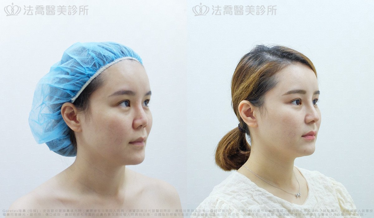 法喬醫美診所,邱浚彥