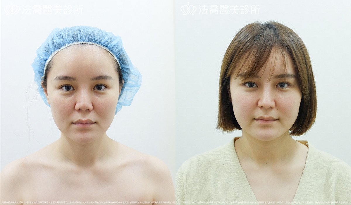 法喬醫美診所,邱浚彥
